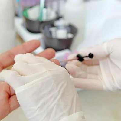 雪碧汞中毒的症状