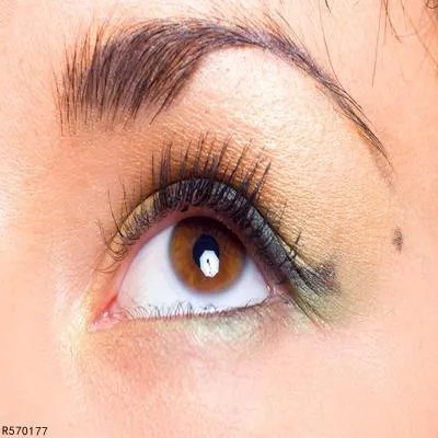 开眼角手术大概得多少钱 开眼角手术收费标准介绍