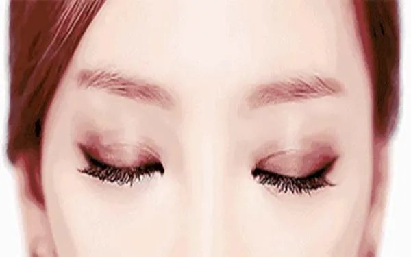 北京去眼袋哪家医院好？