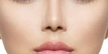 假体隆鼻整形价格是多少