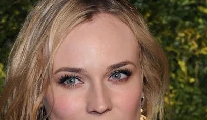 韩式无痕祛眼袋手术价格多少钱