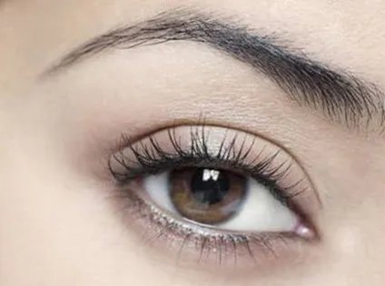 做双眼皮手术恢复时间