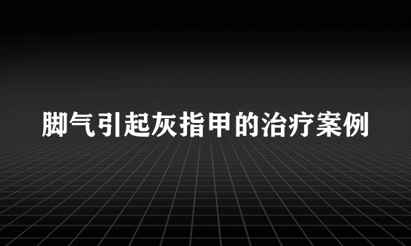 脚气引起灰指甲的治疗案例