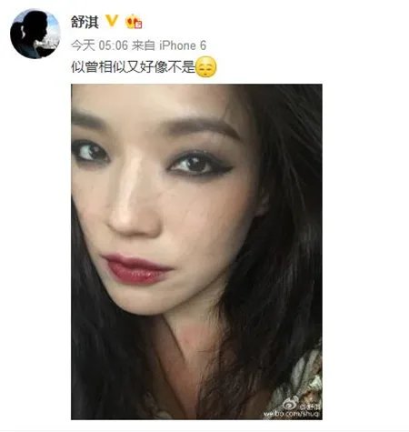 舒淇脖颈惊现红痕  引发网友无数猜想