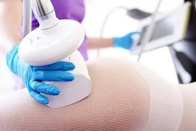 全身吸脂减肥会反弹吗