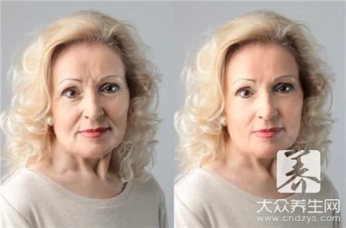 注射除皱效果好吗?