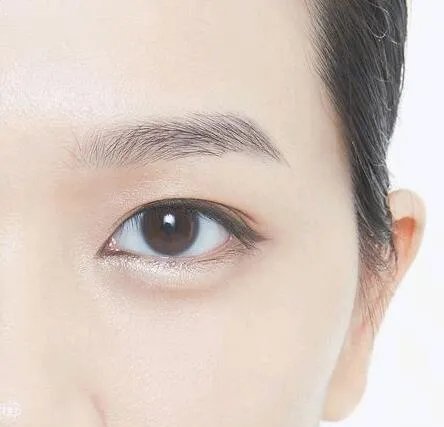 重庆眼部手术哪几个整形医院口碑好