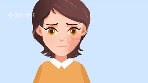 激光祛斑危险吗