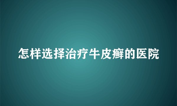 怎样选择治疗牛皮癣的医院