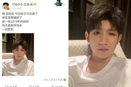 王源成人闪耀山城 源哥回应眼睛被蚊子咬