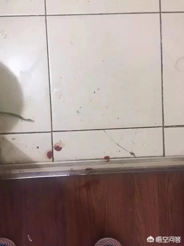 宜家水杯自爆崩断门牙，女子要求宜家赔偿百万，你们认为法院会支持吗？