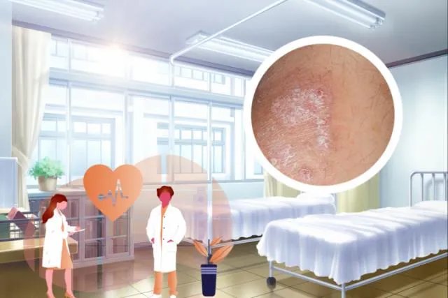 女性银屑病初期症状