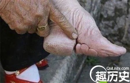 揭秘古代女子为什么缠足?缠足图片触目惊心