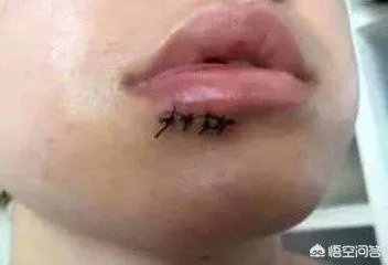 宜家水杯自爆崩断门牙，女子要求宜家赔偿百万，你们认为法院会支持吗？