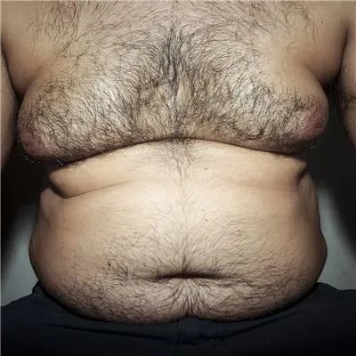 肚皮舞能减肥吗