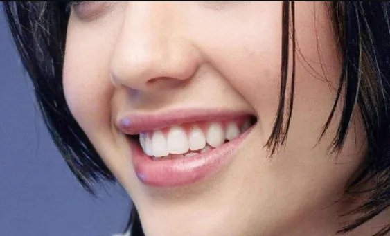 做个综合鼻多少钱