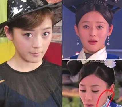 袁姗姗整容前后照片 袁姗姗现在老公是谁