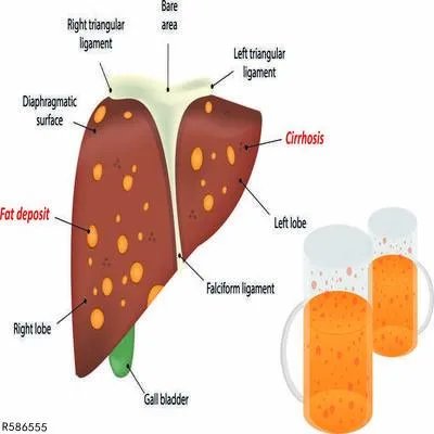 肝病早期症状有哪些