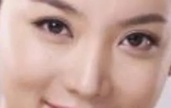 朝天鼻整形价格是多少