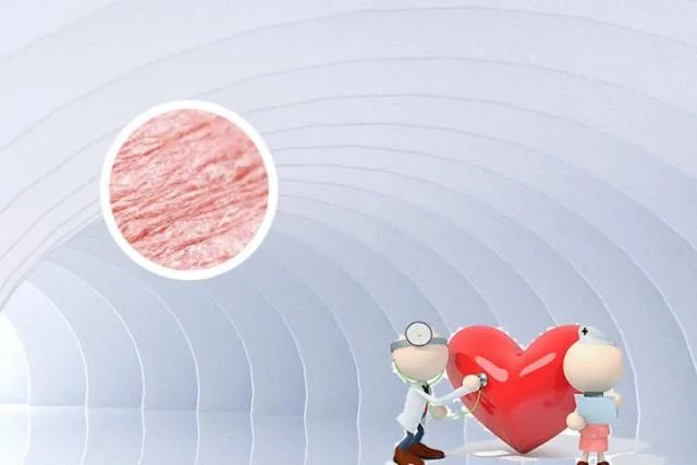 女性银屑病初期症状