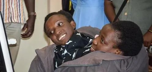 连体婴姐妹啥时候去世？