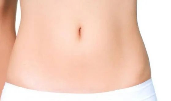 妊娠纹去除价格