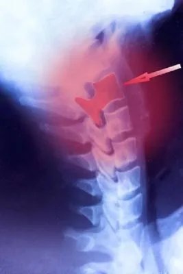 神经症的诊断标准是什么