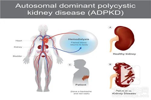 肝功能化验结果分析
