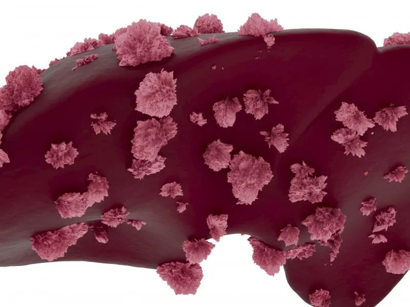 乙肝是不治之症？一定会变成肝癌？这5个误区可别再踩了