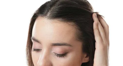 成都发际线植发哪个医院好