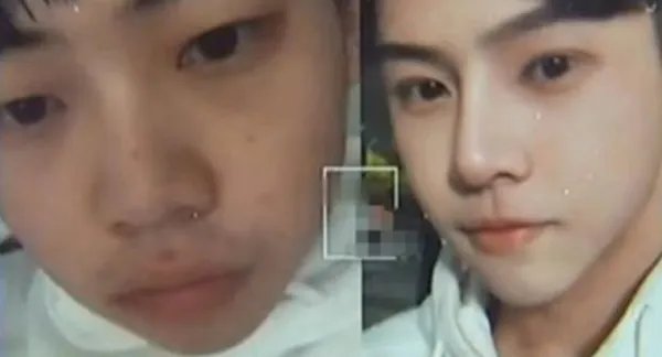 小伙花十几万整容大喊“满意”，为何突然状告整容公司，又发生了什么呢？