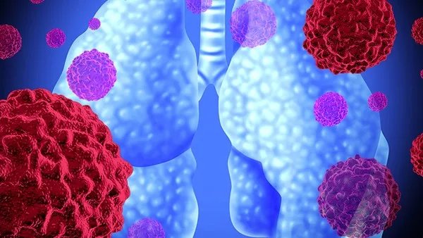 神经外科是看什么病