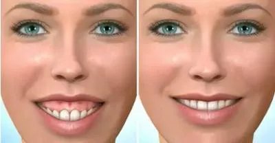 2021重庆维乐口腔牙齿矫正价格表(价目表)怎么样?