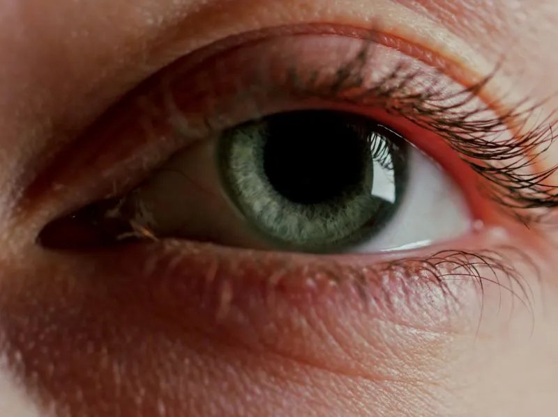 让眼睛变大的手术有哪些